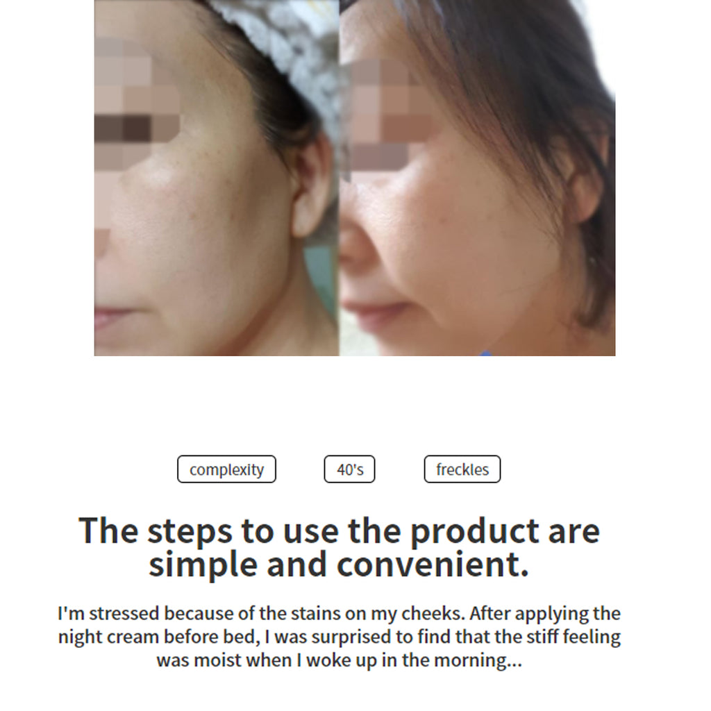 KyoungMi -KyoungMi Hwiyo Lifting Pack | 4 Sheets - Skin Care Masks & Peels - Everyday eMall